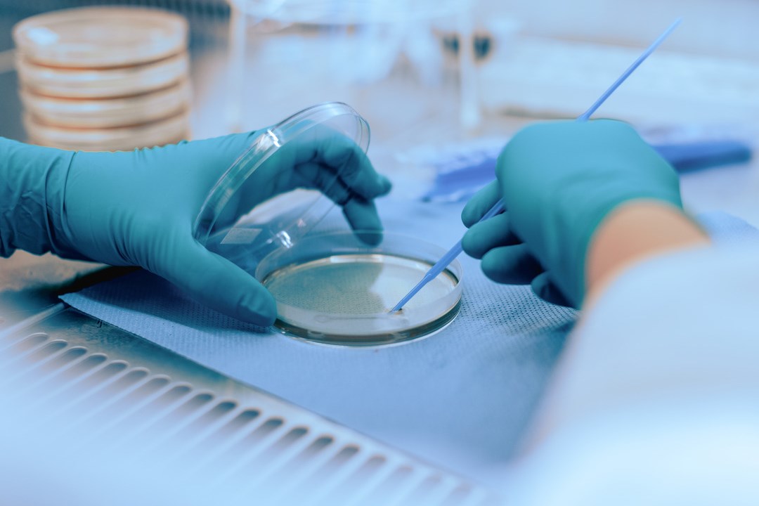 Blue disposable gloves hold petri dish in lab. 